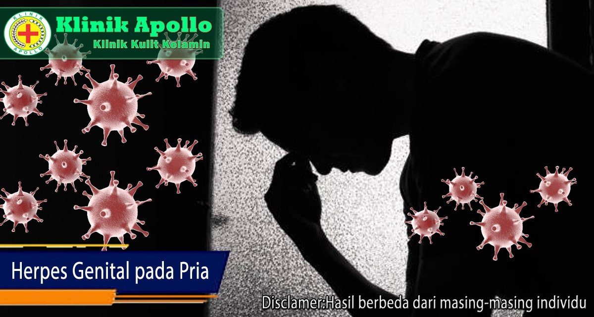 Herpes Genital Pria: Penyebab dan Cara Mengobati