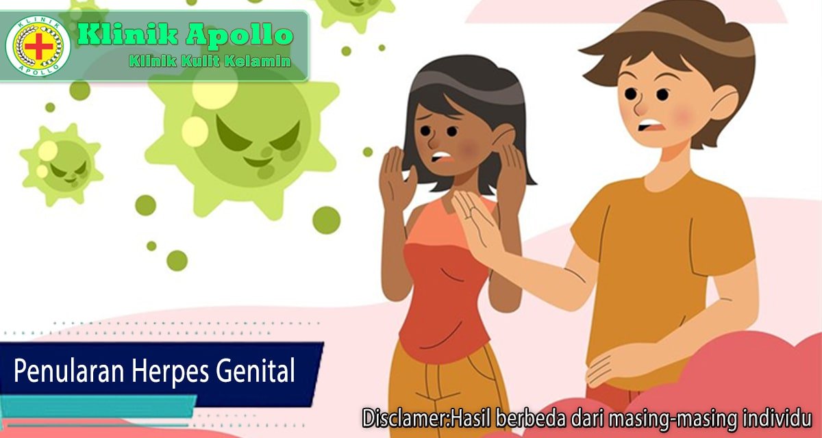 Berbagai Penularan Herpes Genital yang Wajib Diwaspadai!