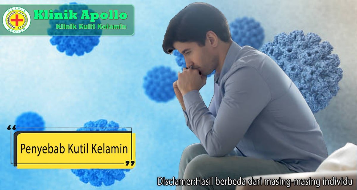 Untuk mengetahui penyebab kutil kelamin adalah dengan melakukan pemeriksaan dengan dokter ahli.