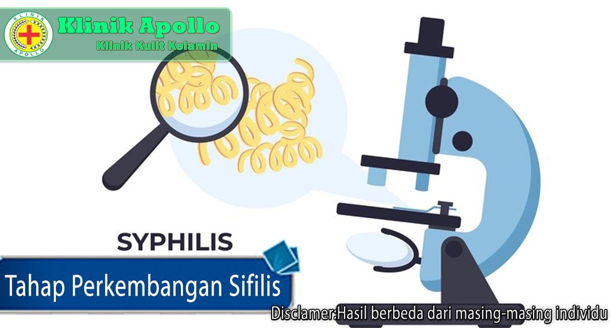Tentang Tahap Perkembangan Sifilis: Definisi dan Gejala