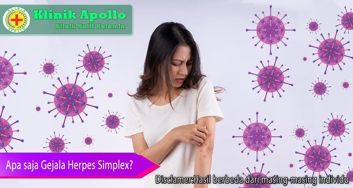 Hubungi dokter ahli untuk penanganan gejala herpes simplex.