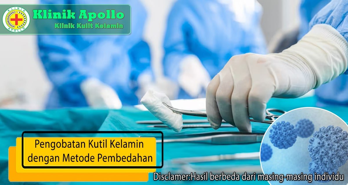 Konsultasi dengan dokter untuk pengobatan kutil kelamin dengan metode pembedahan.