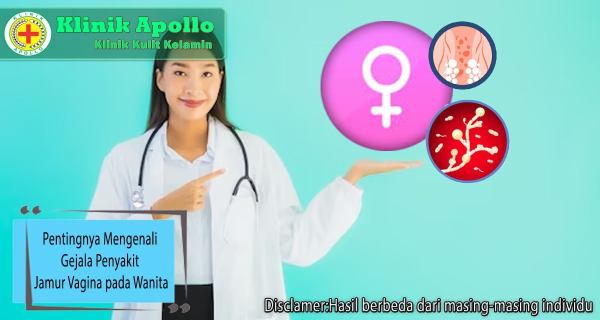 Pentingnya Mengenali Gejala Penyakit Jamur Vagina Klinik Apollo Jakarta