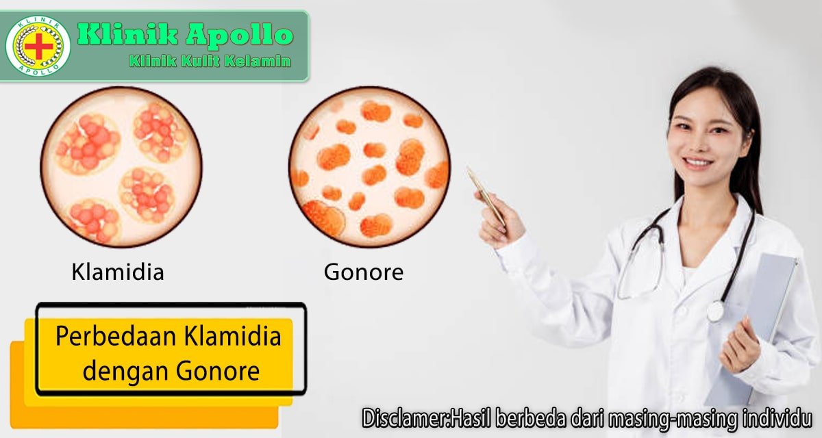 Penanganan yang tepat adalah dengan mengetahui perbedaan klamidia dengan gonore secara lengkap di Klinik Apollo.