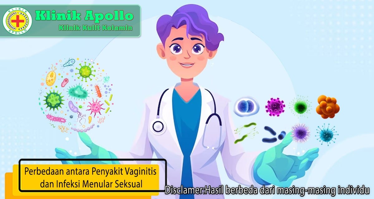 Selalu lakukan konsultasi dengan dokter ahli di Klinik Apollo untuk mengetahui perbedaan vaginitis dan IMS.