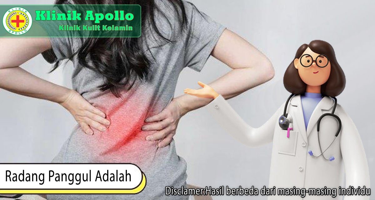 Radang Panggul Adalah? Ketahui Faktor Risiko dan Diagnosisnya