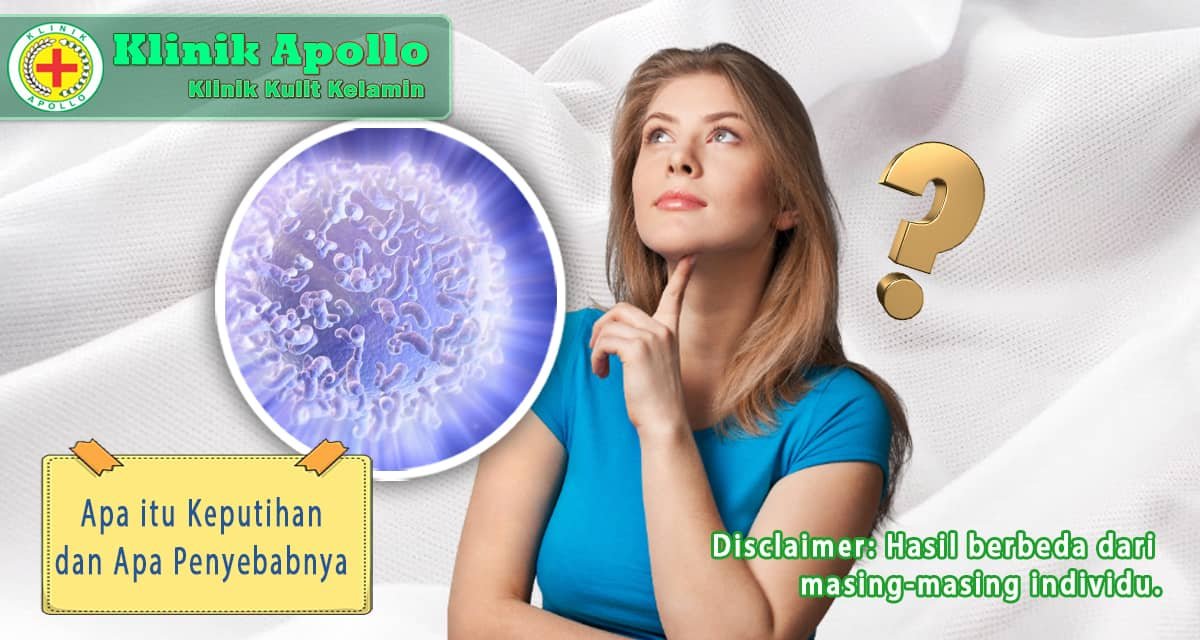 Apa Itu Keputihan Dan Apa Penyebabnya Klinik Apollo Jakarta