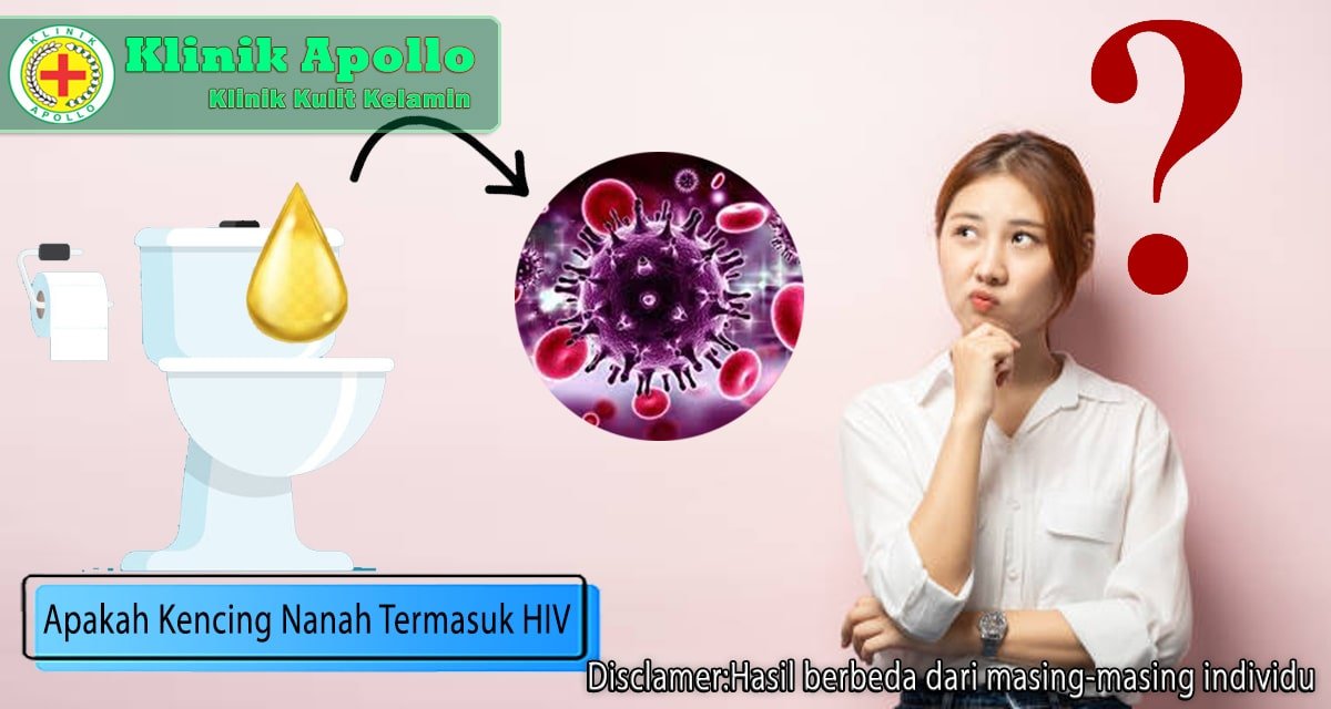 Sama-Sama Mengancam, Apakah Kencing Nanah Termasuk HIV?