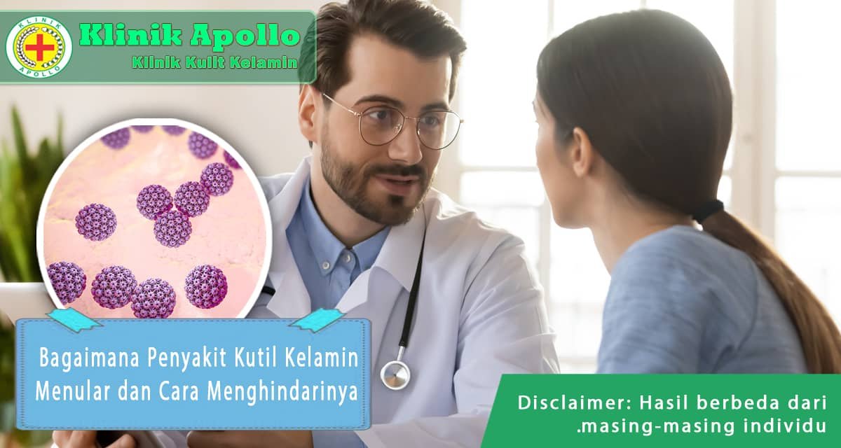 Lakukan pemeriksaan lengkap dengan dokter untuk menghindari kutil kelamin.