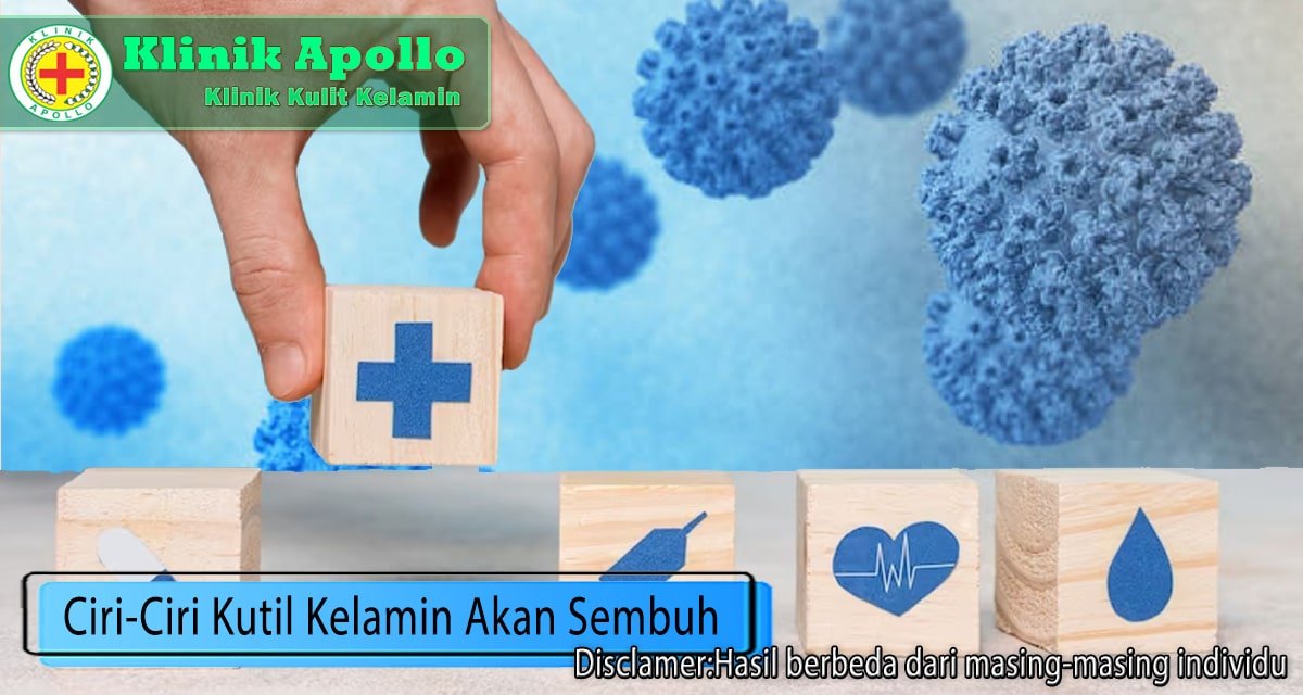 Apa Sajakah Ciri-Ciri Kutil Kelamin yang akan Sembuh? Simak!