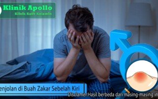 Selalu hubungi dokter ahli andrologi untuk penanganan kondisi ini.