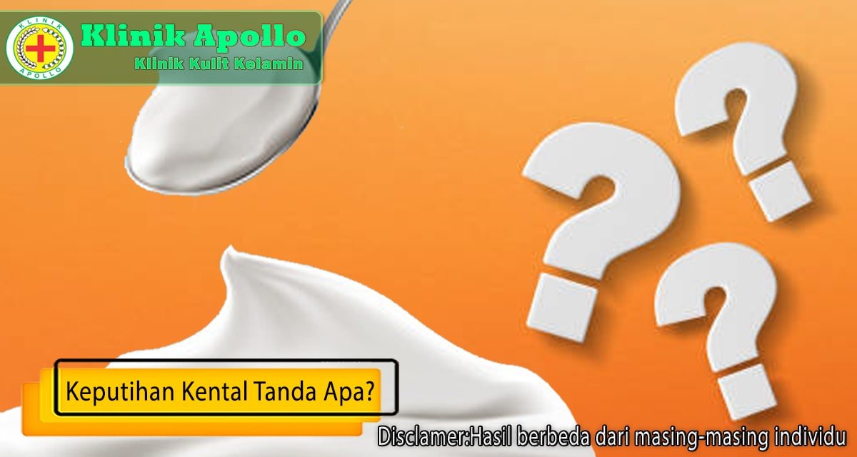 Dapatkan penanganan medis ahli keputihan di Klinik Apollo.