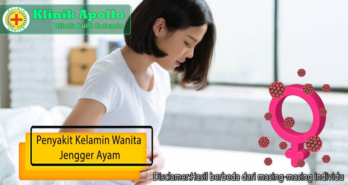 Segera hubung dokter ahli untuk penanganan penyakit jengger ayam pada wanita.