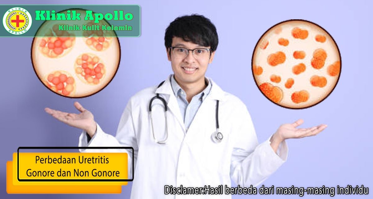 Penanganan untuk uretritis gonore dan non gonore hanya ada di Klinik Apollo.