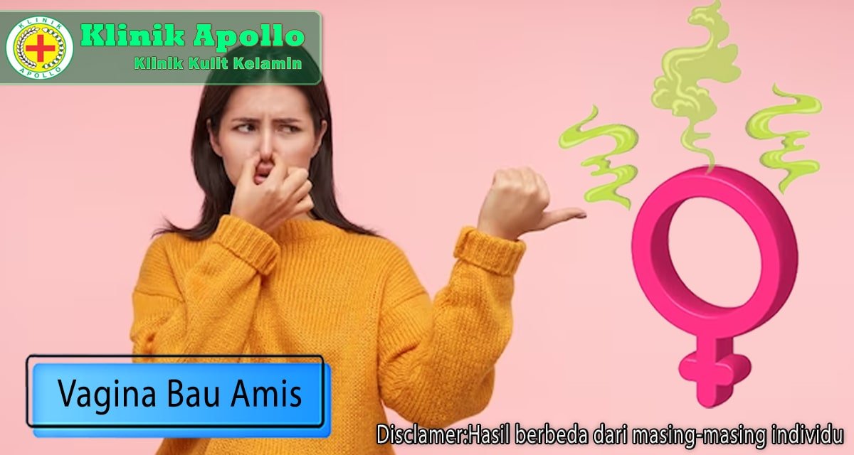 Vagina Bau Amis: Berikut Penyebab dan Cara Menghilangkannya