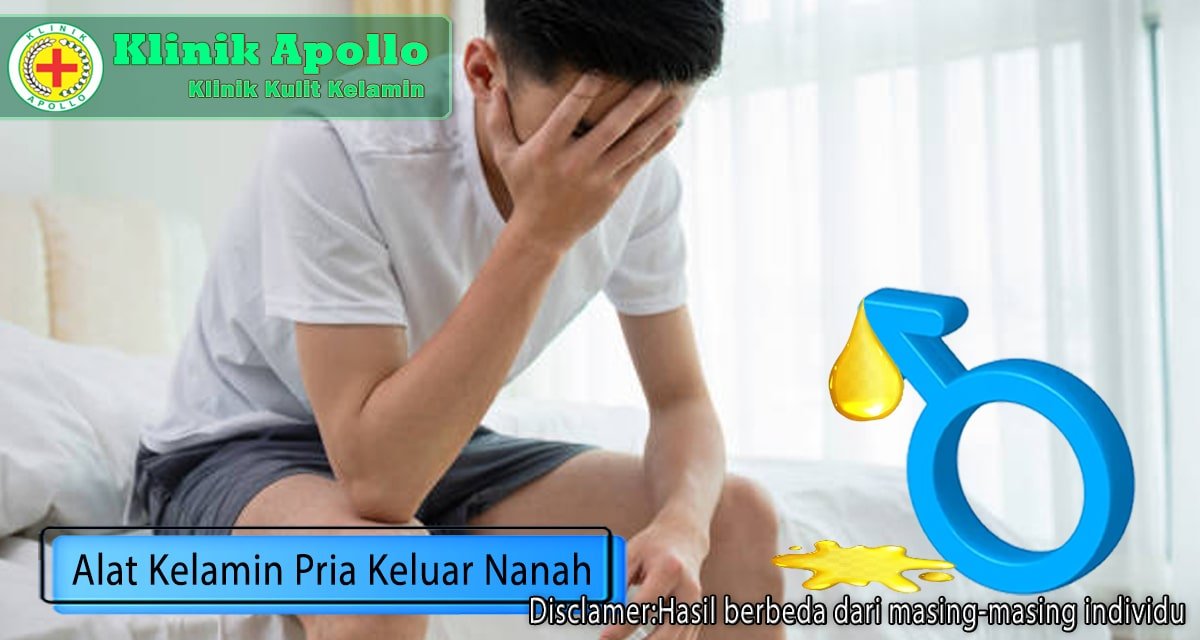 Ilustrasi Alat Kelamin Pria Keluar Nanah