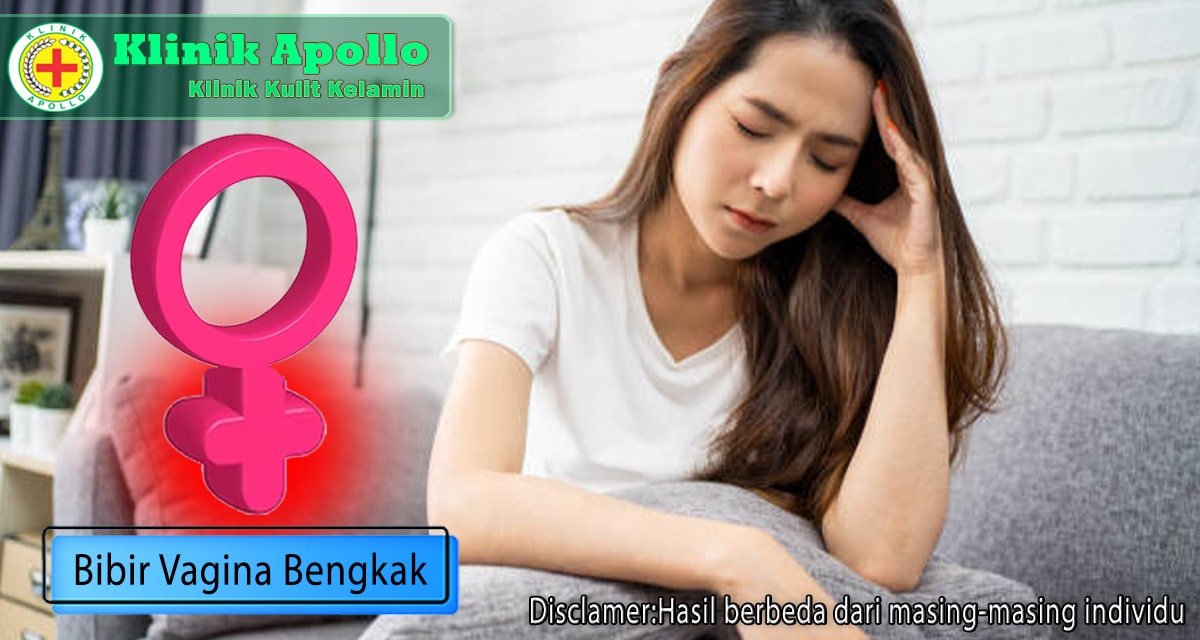 Bibir Vagina Bengkak, Apa Penyebab dan Cara Mengatasinya?