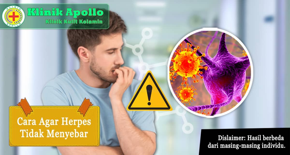 15 Cara agar Herpes Tidak Menyebar: Pahami Sebelum Menyesal