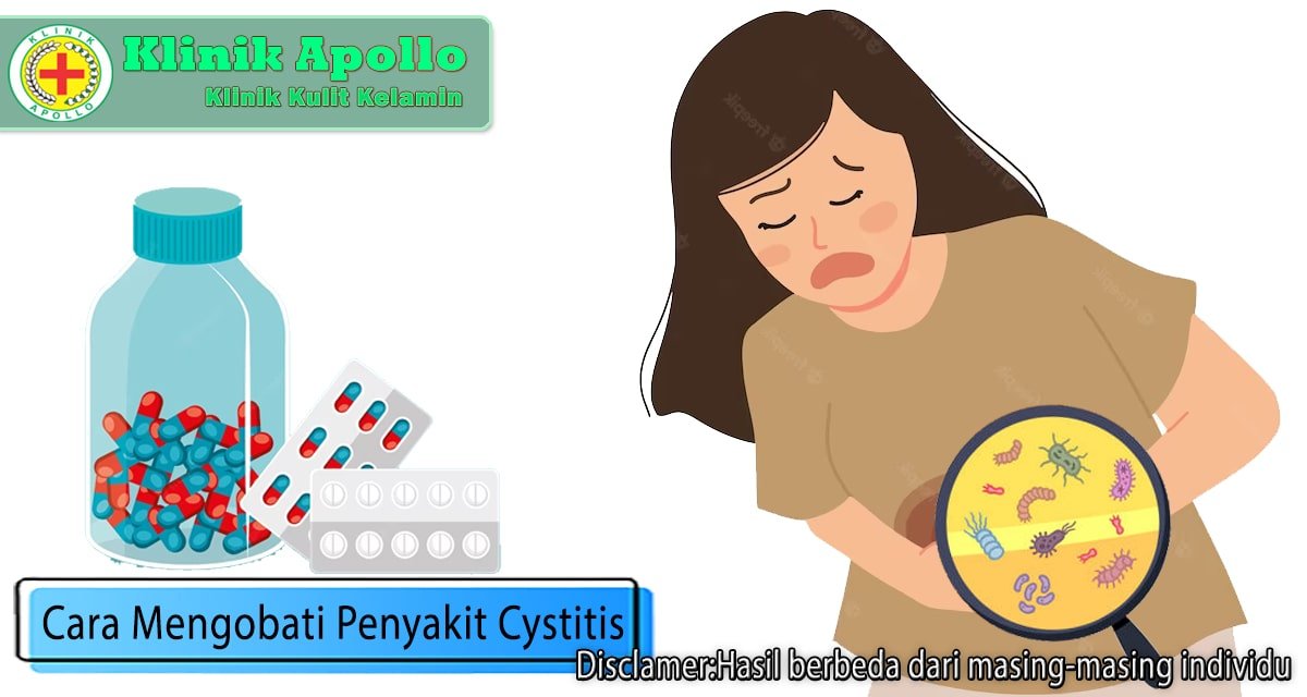 5 Cara Mengobati Penyakit Cystitis, Terbukti Ampuh!