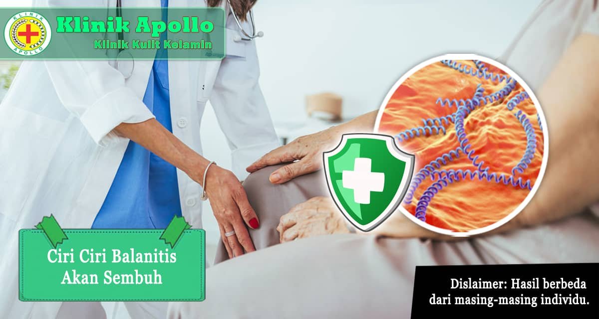 Selalu hubungi dokter ahli balanitis untuk mendapat penanganan lebih lanjut.