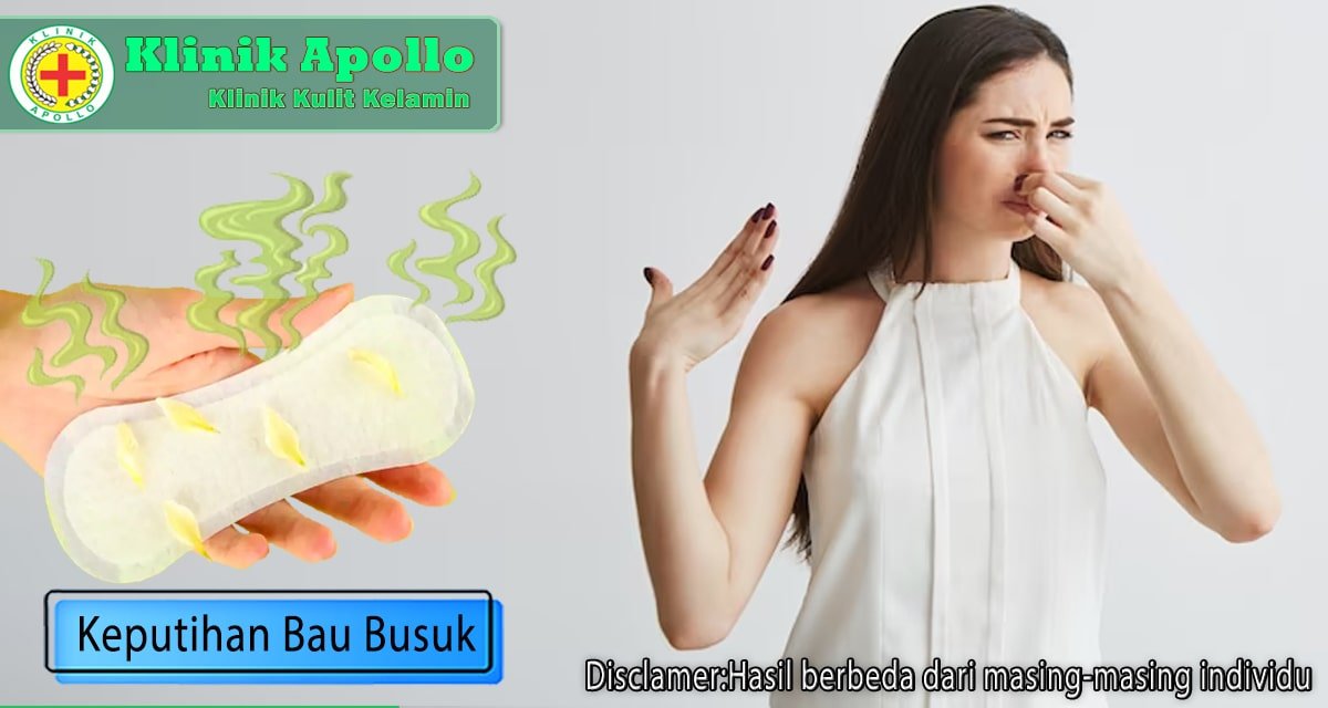 Ciri-ciri dan Risiko Keputihan Bau Busuk