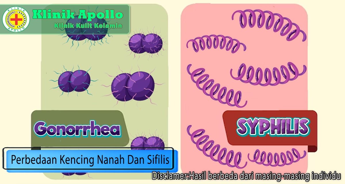 Sama-Sama Menular, Inilah Perbedaan Kencing Nanah dan Sifilis