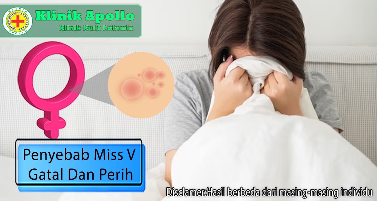 Penyebab Miss V Gatal dan Perih serta Cara Mengatasinya