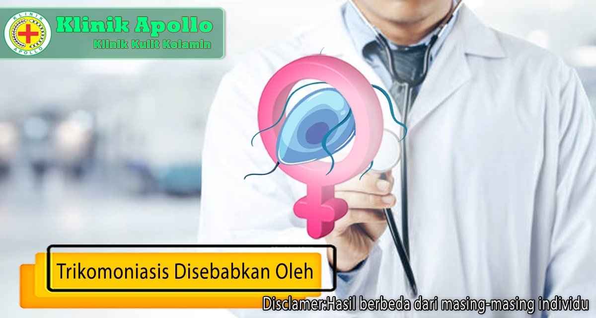 Trikomoniasis Disebabkan Oleh Parasit Berbahaya