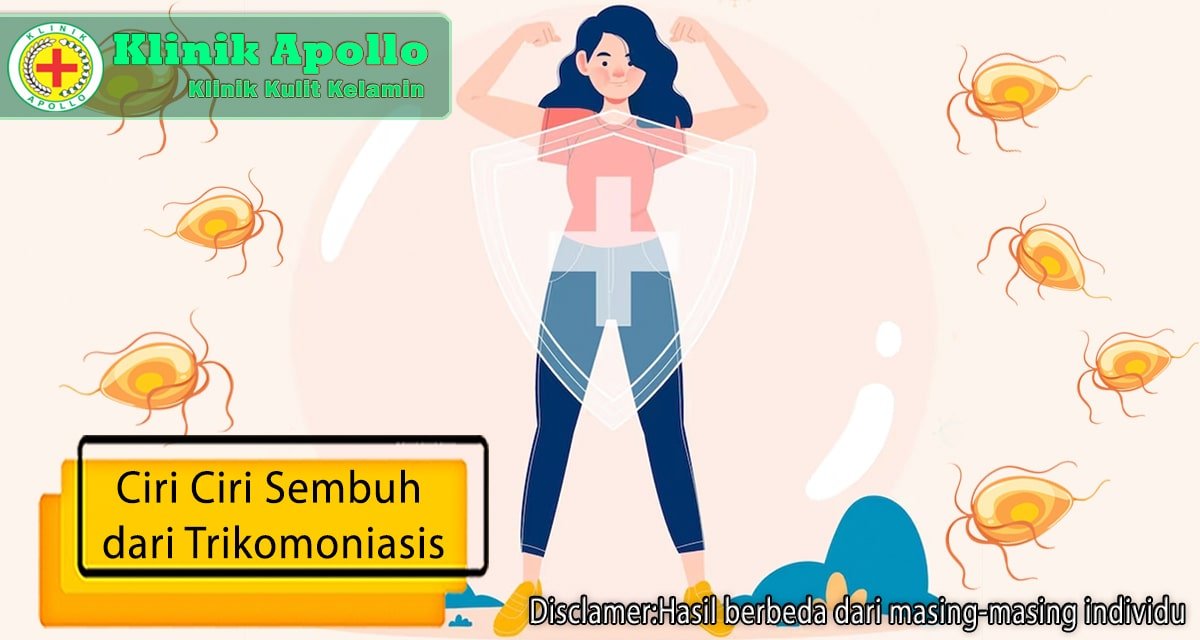 Ilustrasi Ciri-ciri Sembuh dari Trikomoniasis Setelah Pengobatan