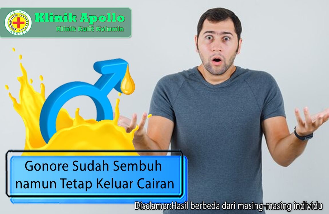 Ilustrasi Gonore Sudah Sembuh Namun Tetap Keluar Cairan