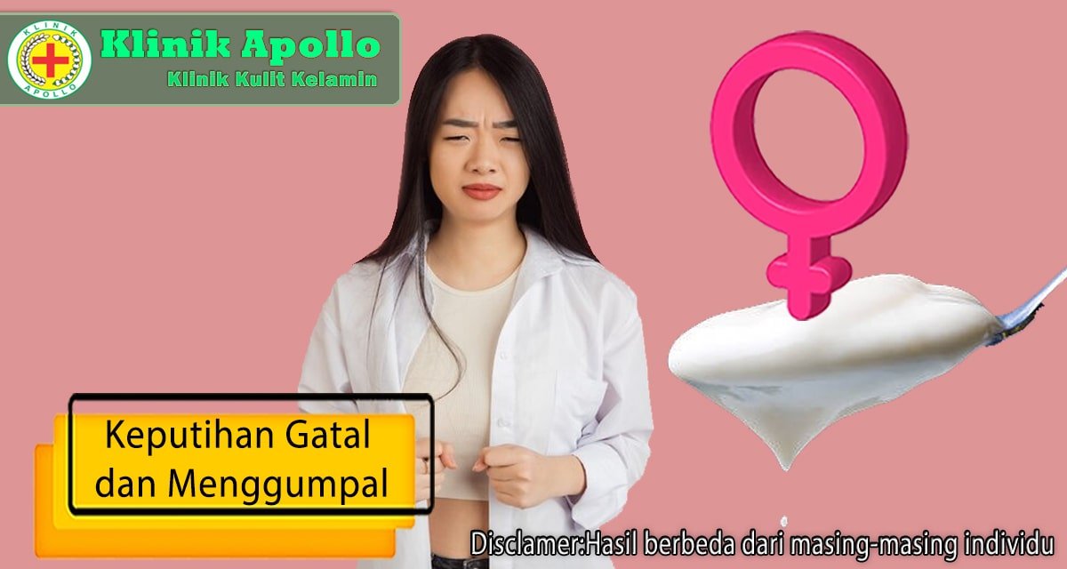 Keputihan Gatal Dan Menggumpal Pada Wanita Klinik Apollo Jakarta 3993