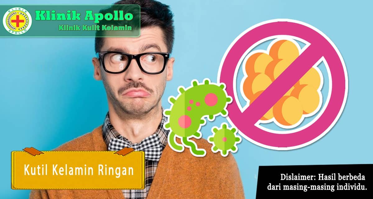 Pengobatan Ampuh Untuk Kutil Kelamin Ringan Klinik Apollo Jakarta 5304