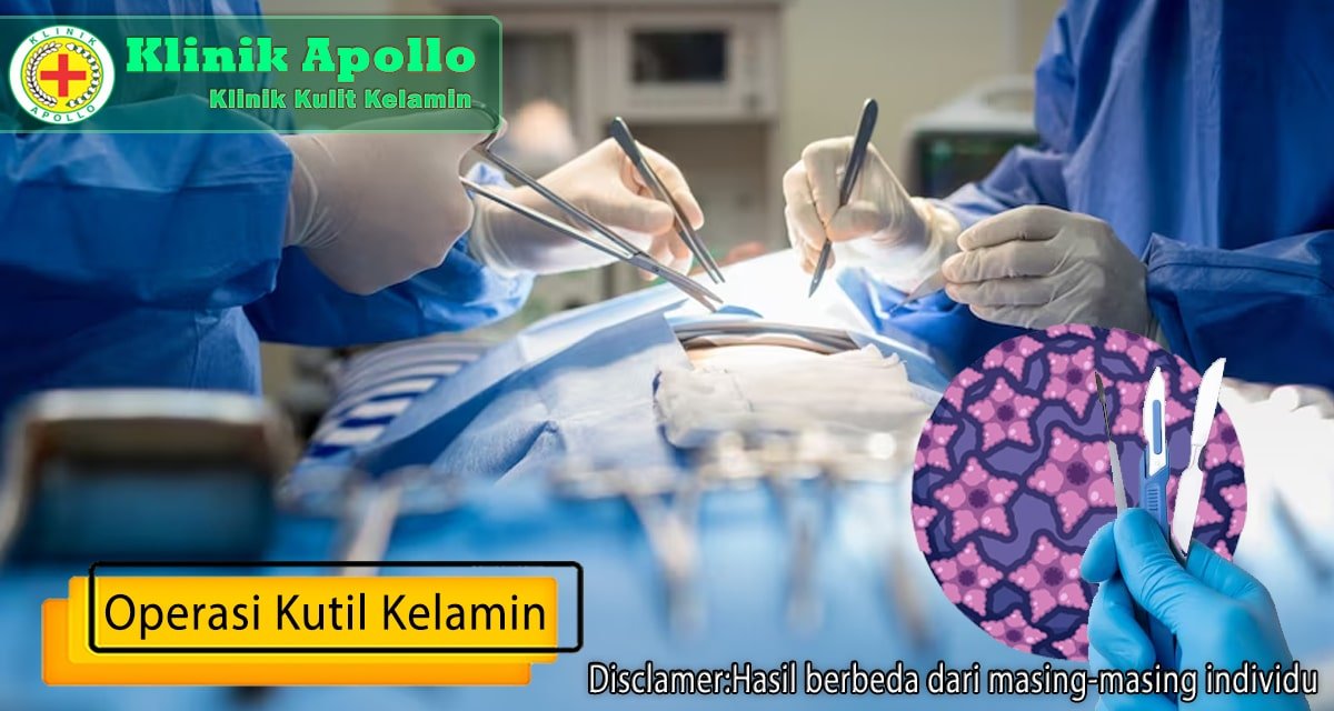 Percayakan operasi kutil kelamin Anda hanya di Klinik Apollo Jakarta.