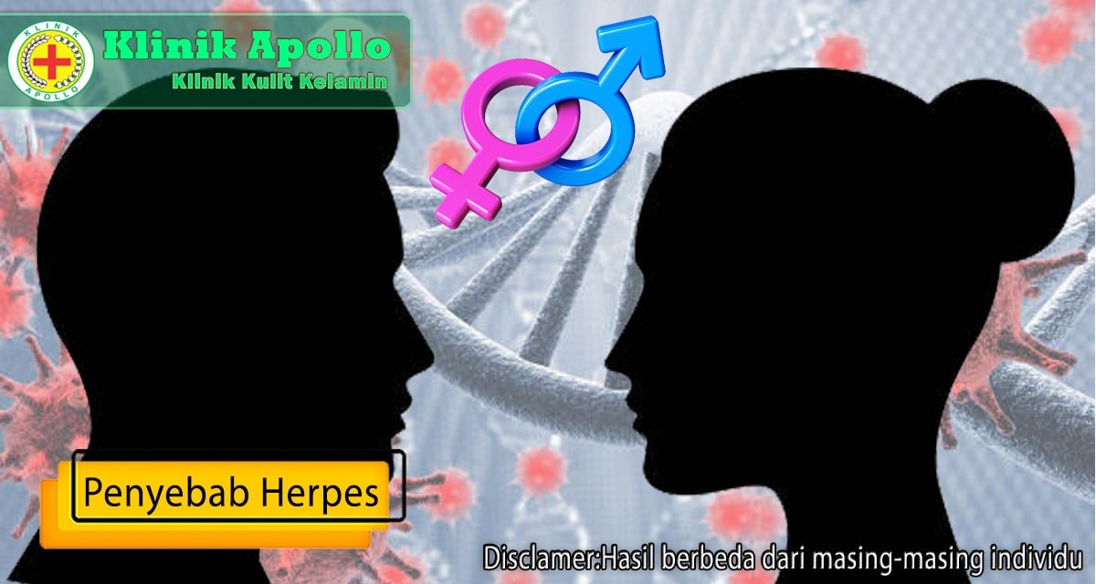 Setelah melakukan pemeriksan dan konsultasi dengan dokter ahli, Anda dapat mengetahui penyebab herpes.