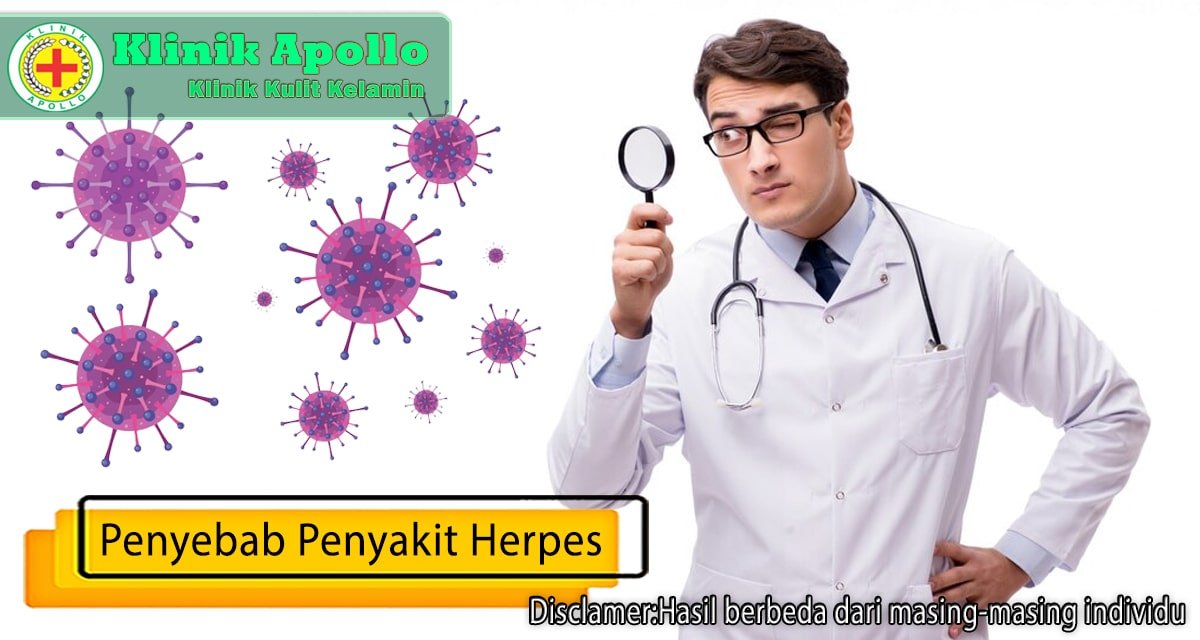 Dengan pemeriksaan medis ahli, Anda dapat mengetahui penyebab penyakit herpes.