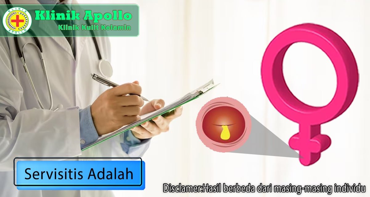 Servisitis adalah kondisi medis yang harus mendapatkan penanganan.