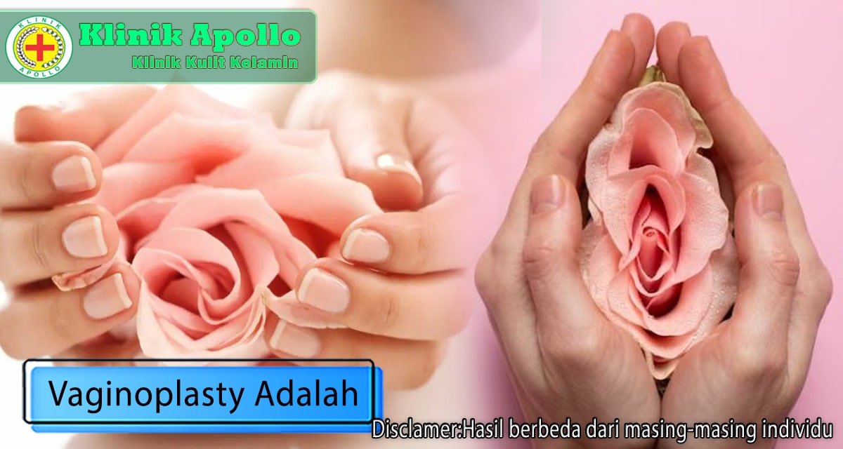 Vaginoplasty adalah salah satu prosedur canggih yang ada di Klinik Apollo dengan dokter ahli.