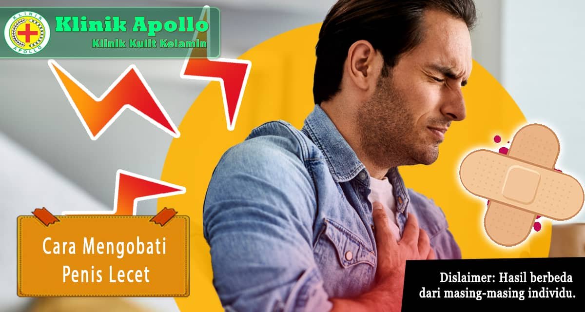 Selalu lakukan pemeriksaan dan cara mengobati penis lecet pada pria di Klinik Apollo.