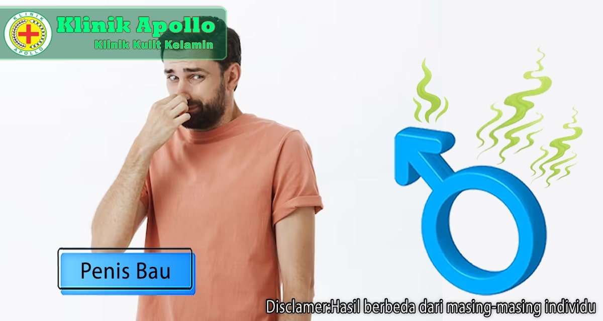 Penis Bau Tidak Sedap? Begini Cara untuk Menghilangkannya!