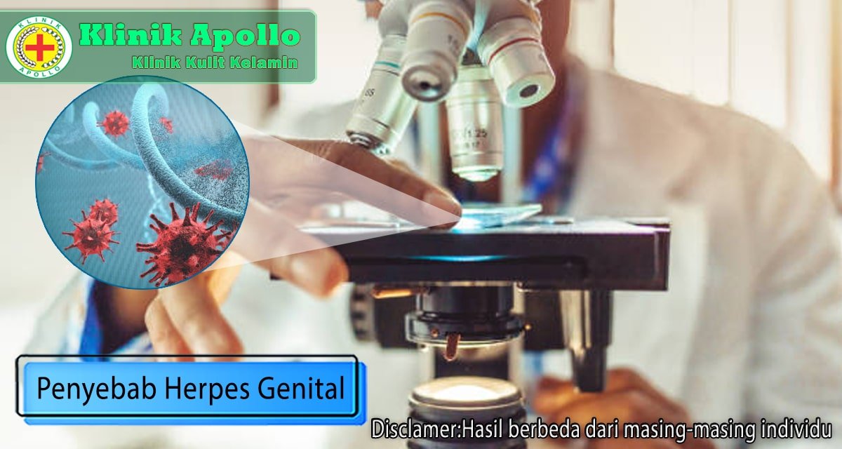 Penyebab Herpes Genital dan Cara Menularkan Infeksinya