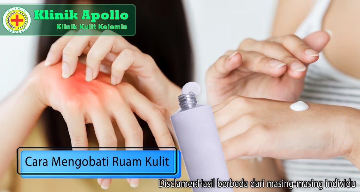 Jangan Didiamkan, Begini Cara Mengobati Ruam Kulit yang Ampuh