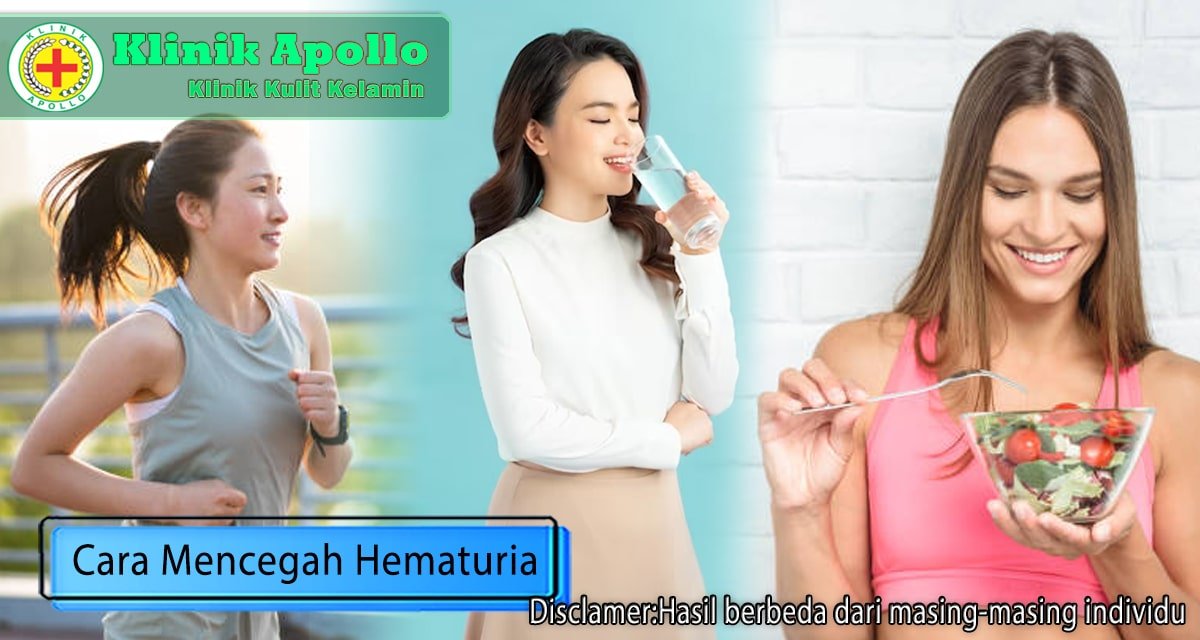 5 Cara Mencegah Hematuria, dari Olahraga hingga Makanan Sehat