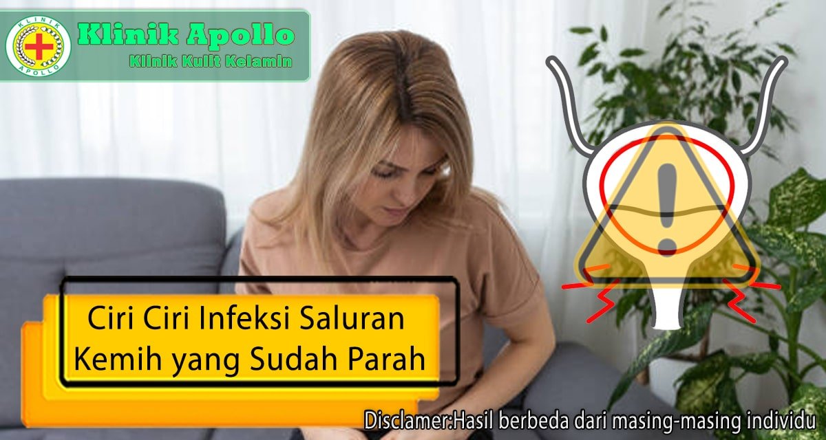 Ciri Ciri Infeksi Saluran Kemih Yang Sudah Parah Dan Bahayanya Klinik   Ciri Ciri Infeksi Saluran Kemih Yang Sudah Parah Min 