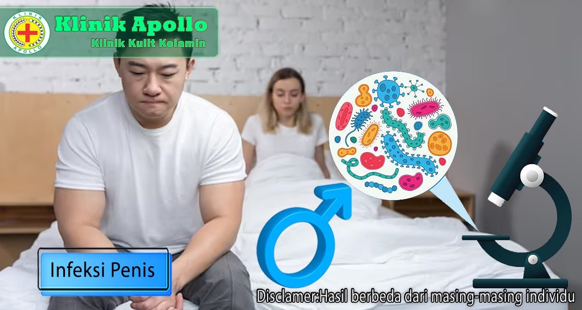 Tanda-Tanda Infeksi Penis dan Cara Mencegahnya