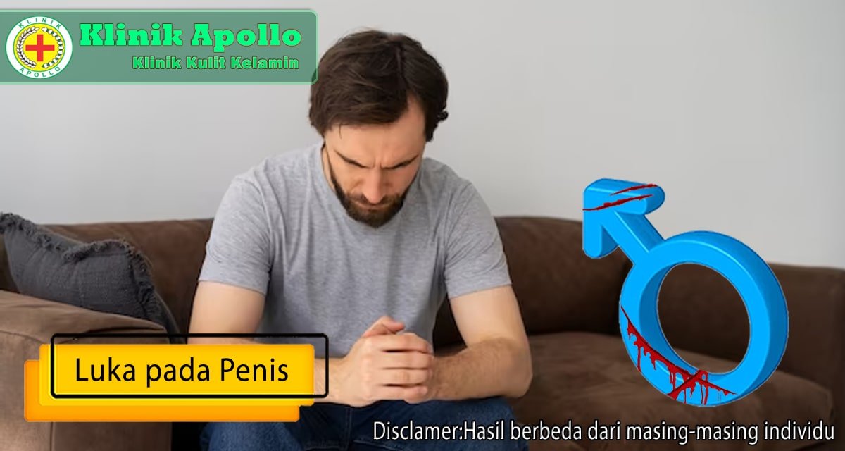 Pria mengalami luka pada penis harus segera dilakukan pengobatan di Klinik Apollo.