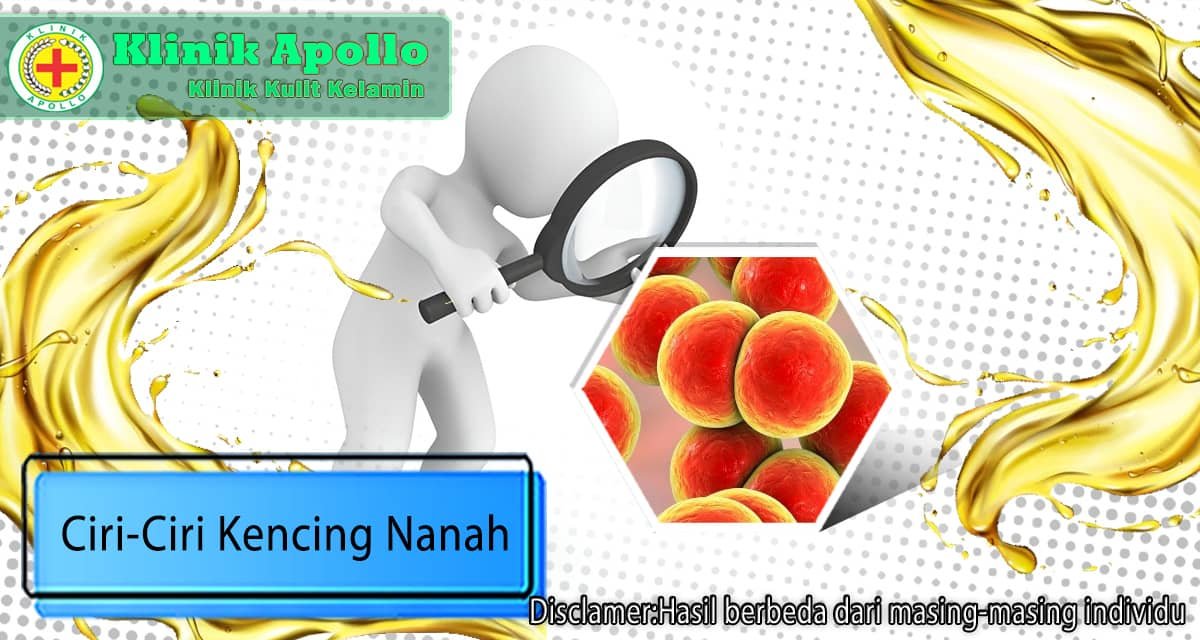 Dengan Anda melakukan pemeriksaan medis, Anda dapat mengetahui ciri-ciri kencing nanah sebelum melakukan pengobatan.