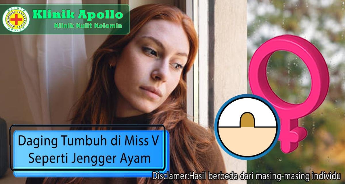 Segera lakukan penanganan menangani daging tumbuh di miss v seperti jengger ayam pada wanita di Klinik Apollo Jakarta.