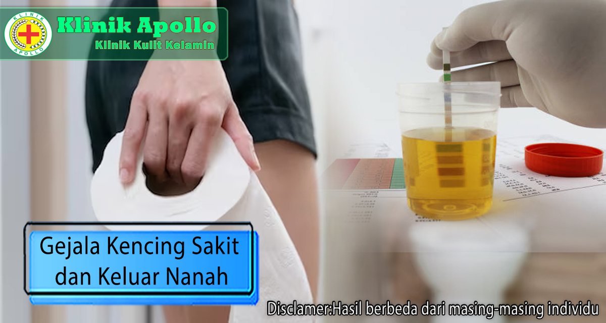 Mengalami gejala kencing sakit dan keluar nanah harus segera diobati dengan cepat dan tepat.