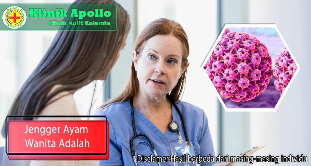 Jengger ayam wanita adalah kondisi yang dapat ditangani di Klinik Apollo Jakarta.