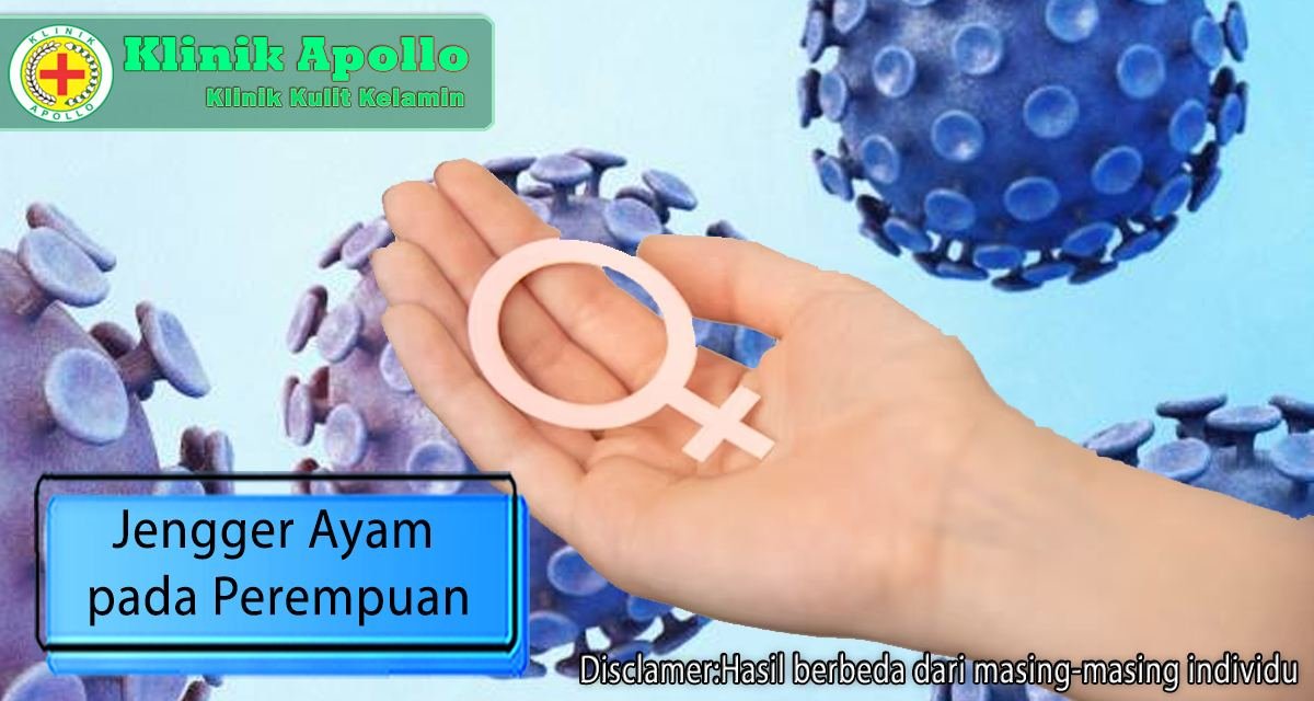 Penanganan terbaik untuk jengger ayam pada perempuan hanya ada di Klinik Apollo Jakarta.